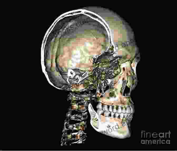 CT Scan Image Of A Skull For Age Estimation Age Estimation: A Multidisciplinary Approach