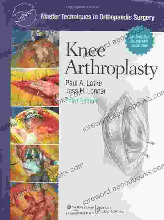 Knee Arthroplasty Master Techniques Book Cover Master Techniques In Orthopedic Surgery: Knee Arthroplasty (Master Techniques In Orthopaedic Surgery)