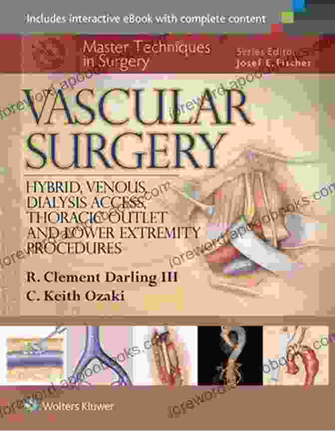 Master Techniques In Surgery Book Cover Master Techniques In Surgery: Thoracic Surgery: Transplantation Tracheal Resections Mediastinal Tumors Extended Thoracic Resections