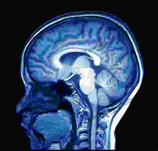 MRI Scan Image Of A Brain For Age Estimation Age Estimation: A Multidisciplinary Approach