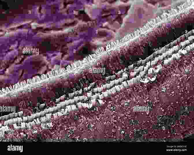 Scanning Electron Micrograph Of The Mammalian Cochlea Showing Primary Auditory Neurons The Primary Auditory Neurons Of The Mammalian Cochlea (Springer Handbook Of Auditory Research 52)