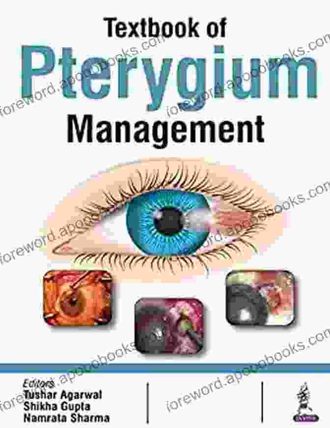 Textbook Of Pterygium Management Book Cover Textbook Of Pterygium Management Tushar Agarwal