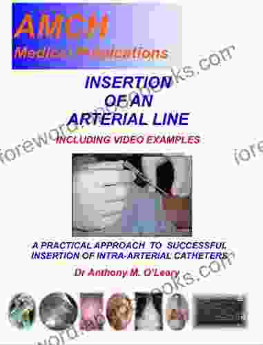 INSERTION OF AN ARTERIAL LINE: A practical approach to successful insertion of intra arterial catheters