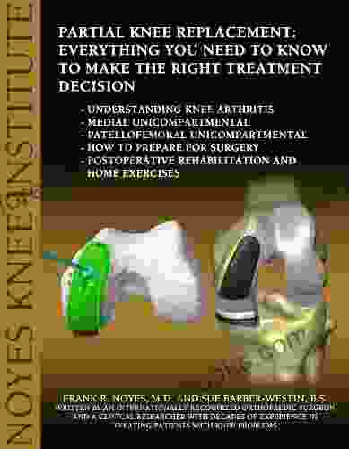 Partial Knee Replacement: Everything You Need To Know To Make The Right Treatment Decision: Understanding Knee Arthritis Medial Unicompartmental Patellofemoral Unicompartmental How To Prepare Fo