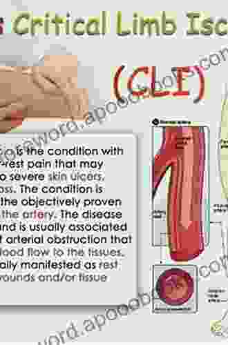 Critical Limb Ischemia Marten Julian