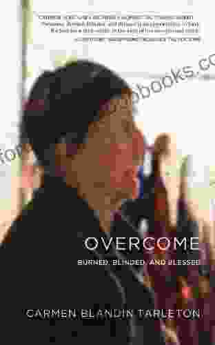 Overcome: Burned Blinded And Blessed